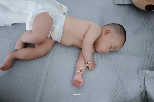 常德六个月宝宝眼睛散光
